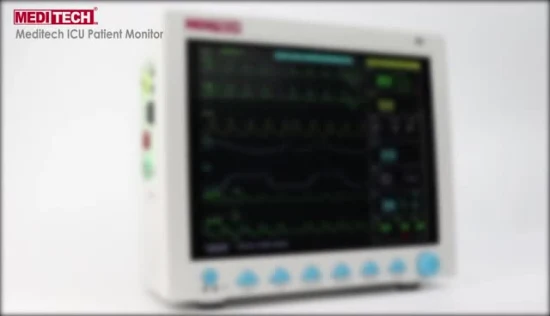 Прямой мониторинг оборудования для оказания первой медицинской помощи сердечным пациентам с завода